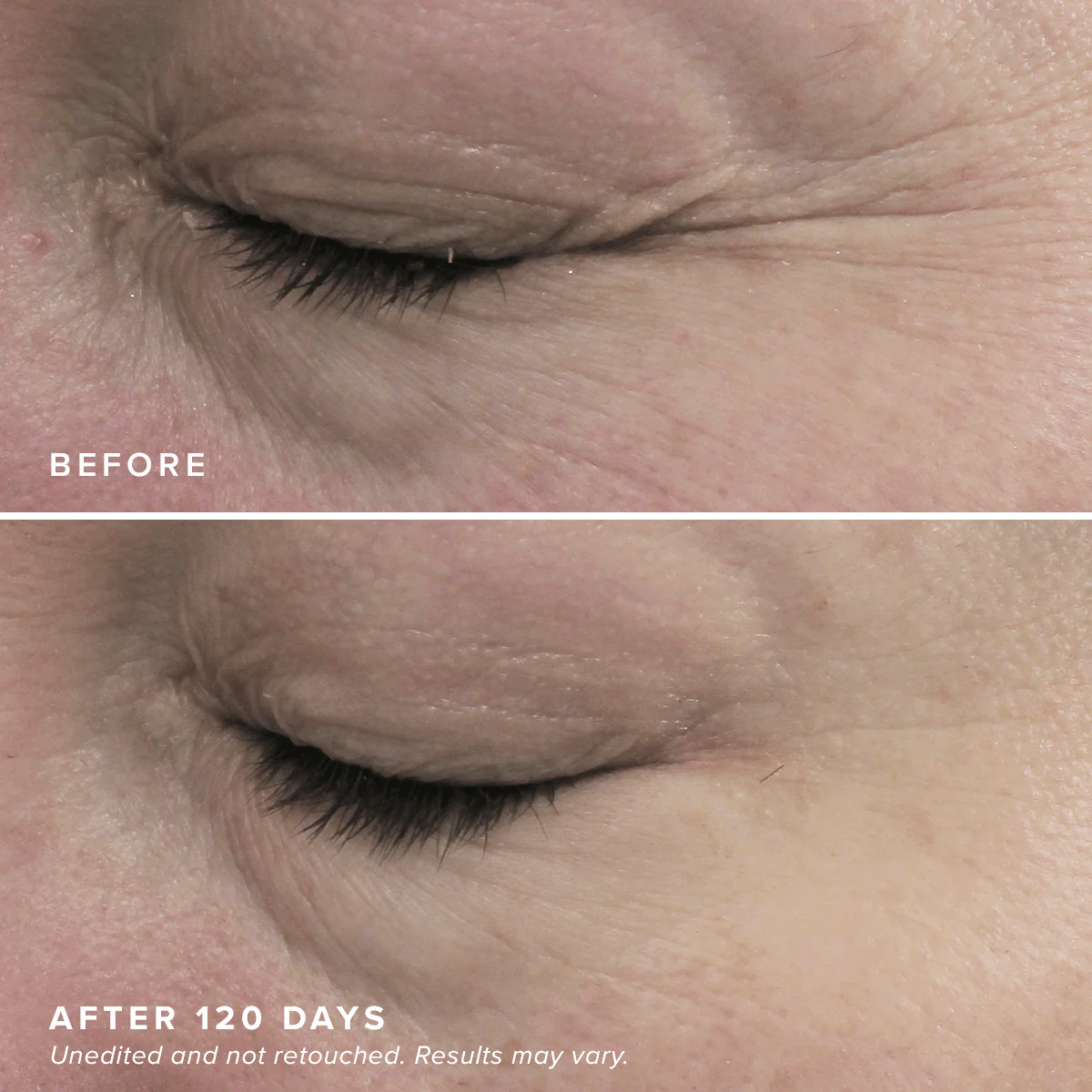 HPR Eye Cream - Image 7